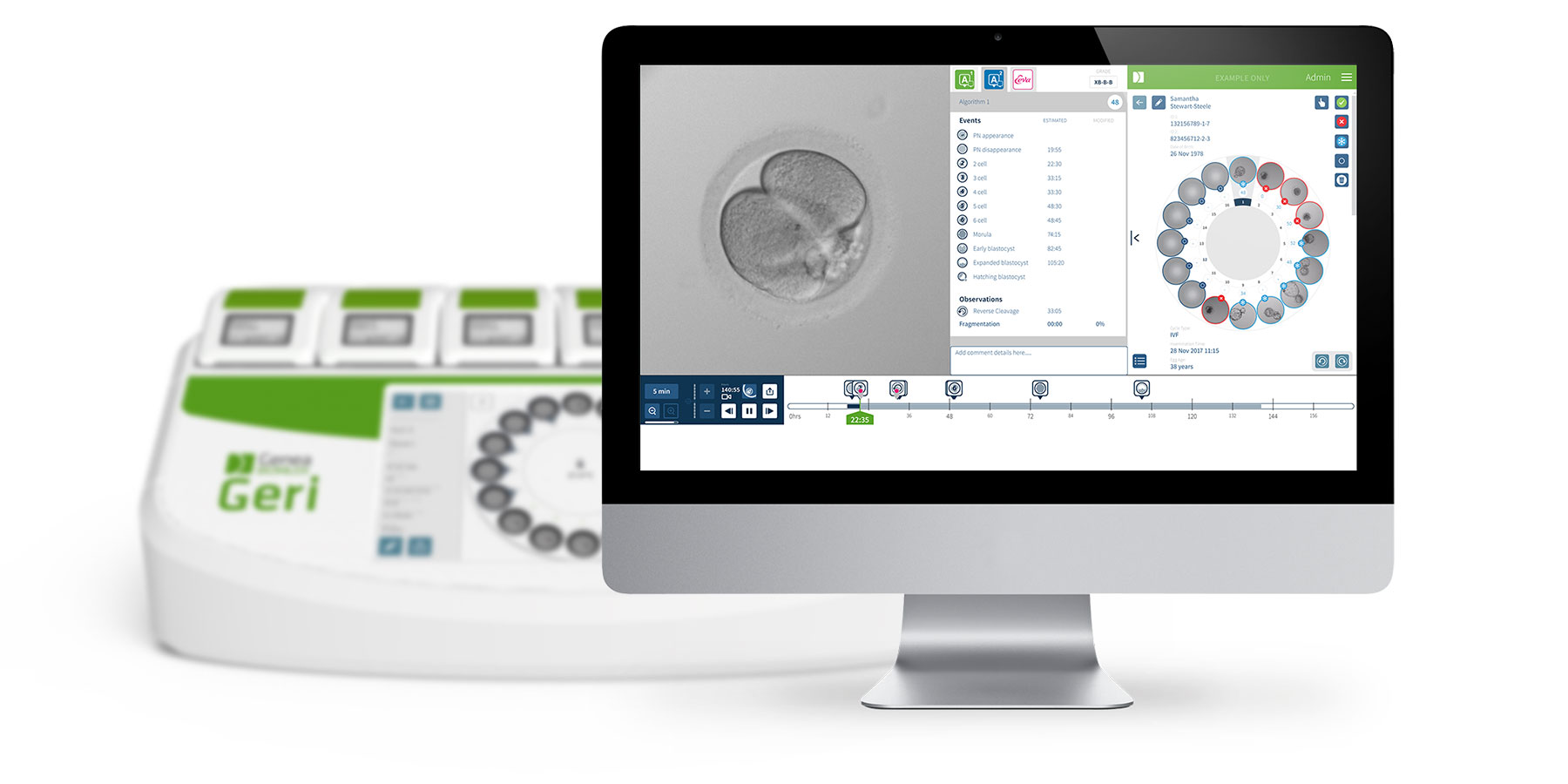 Der GERI-Time-Lapse-Inkubator: die Zukunft der Embryokultur beginnt jetzt