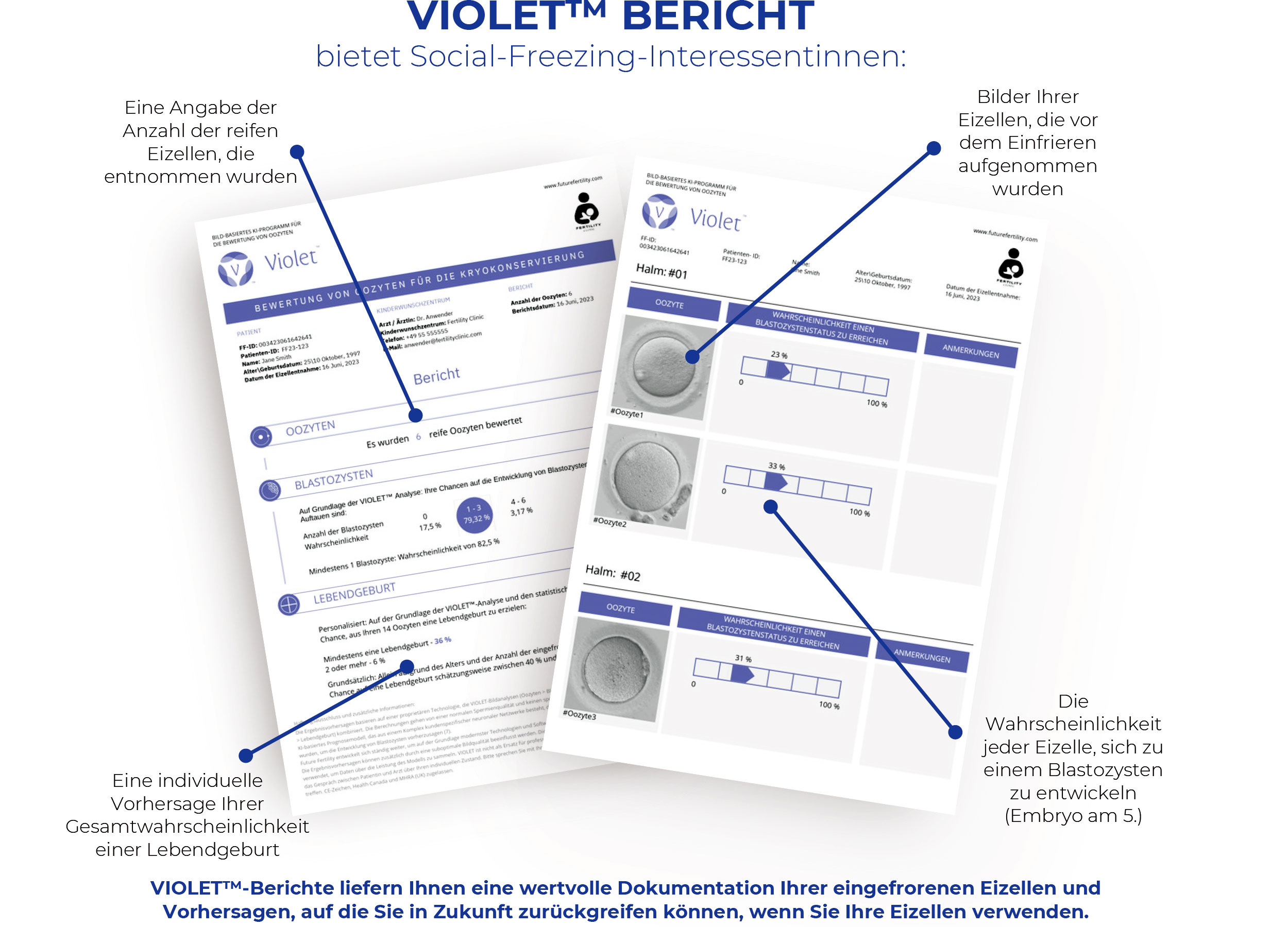 Erhalten Sie individuelle Informationen über die Qualität Ihrer Eizellen, um das Social-Freezing optimal zu planen.